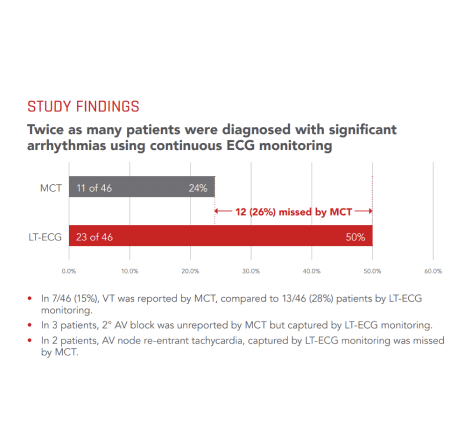 Chart showing study findings on the diagnosis of arrhythmia using continuous ECG monitoring relative to MCT
